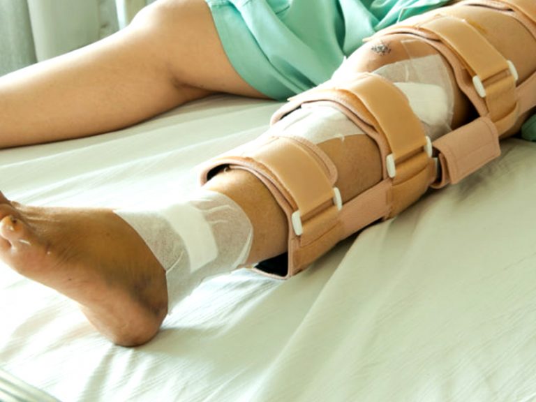 ankle fracture treatment center in Bhubaneswar
