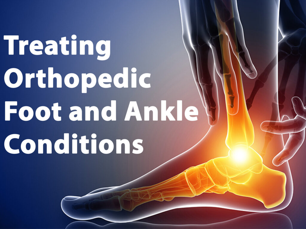 Treating orthopaedic foot and ankle conditions – Foot ankle ortho