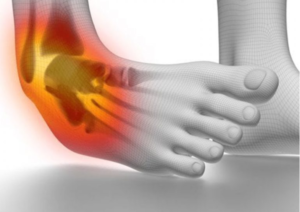 footankle ligament injury repair
