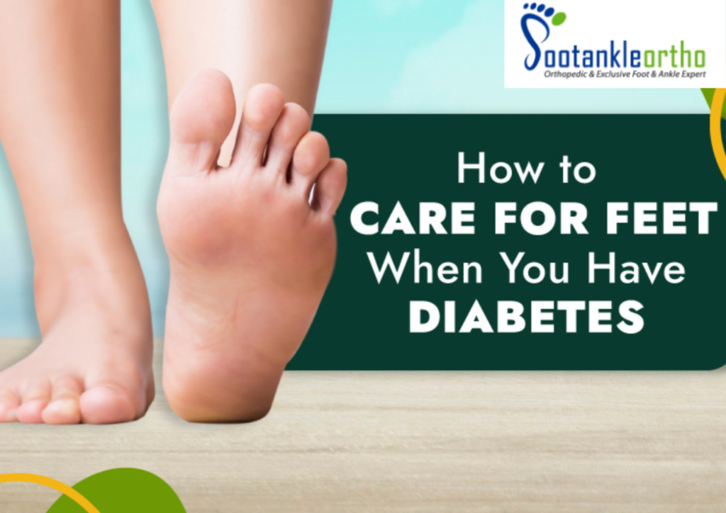 Diabetic foot care clinic