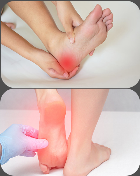 Heel pain Tretment