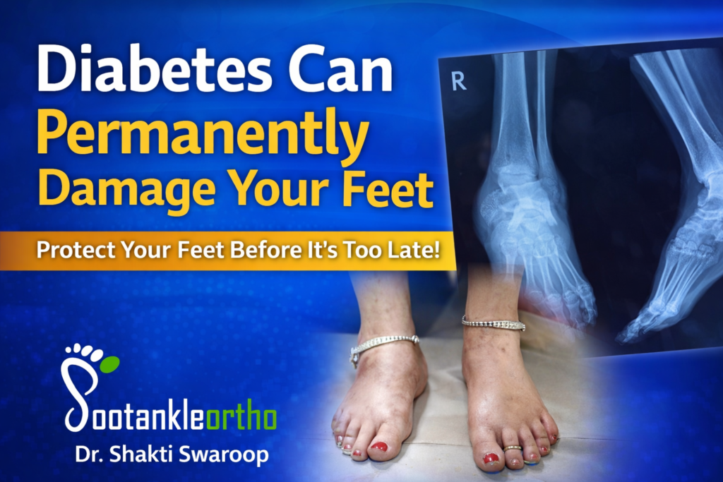 Diabetes Can Permanently Damage Your Feet – Protect Your Feet Before It’s Too Late | Dr. Shakti Swaroop 2 Diabetes Management