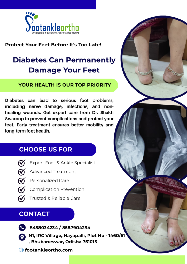 Diabetes Can Permanently Damage Your Feet – Protect Your Feet Before It’s Too Late | Dr. Shakti Swaroop 3 FAO 2026- dibetic care