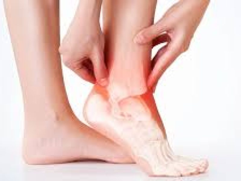 ankle Arthritis